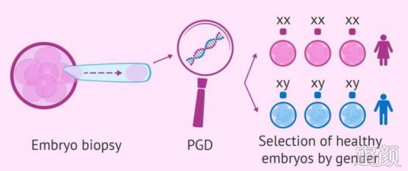 羊水穿刺检查与胎儿染色体疾病风险评估